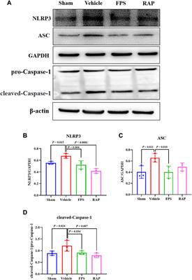 Fucoidan Alleviates Renal Fibrosis in Diabetic Kidney Disease via Inhibition of NLRP3 Inflammasome-Mediated Podocyte Pyroptosis